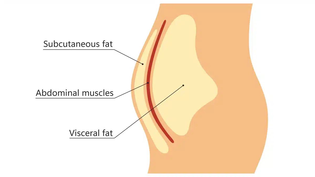 Greix visceral i subcutani al voltant de la cintura. Ubicació del greix visceral a la cavitat abdominal. Tipus d'obesitat humana. Pla mèdic. Il·lustració vectorial aïllada en fons blanc