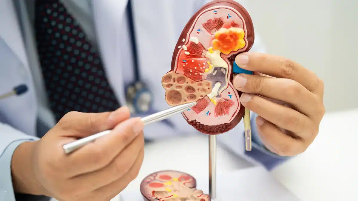 ronyó amb insuficiencia renal